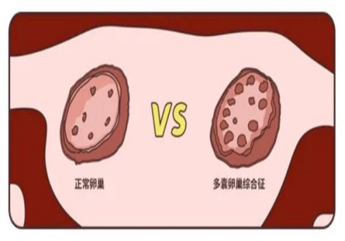 湖州试管助孕价格：孕37周检测知识分享，附宫高腹围正常值参考