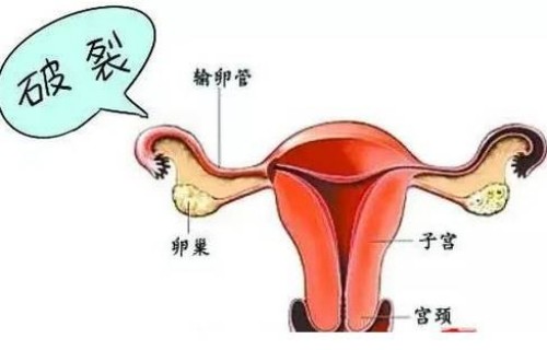孕期7个月怎样处理感冒咳嗽,治疗感冒咳嗽的小妙招